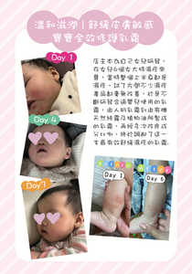 溫和滋潤 | 舒緩皮膚敏感 - 寶寶全效修護乳霜